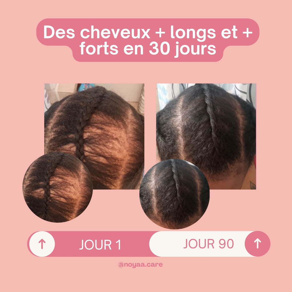 Élixir de pousse 100 % naturel